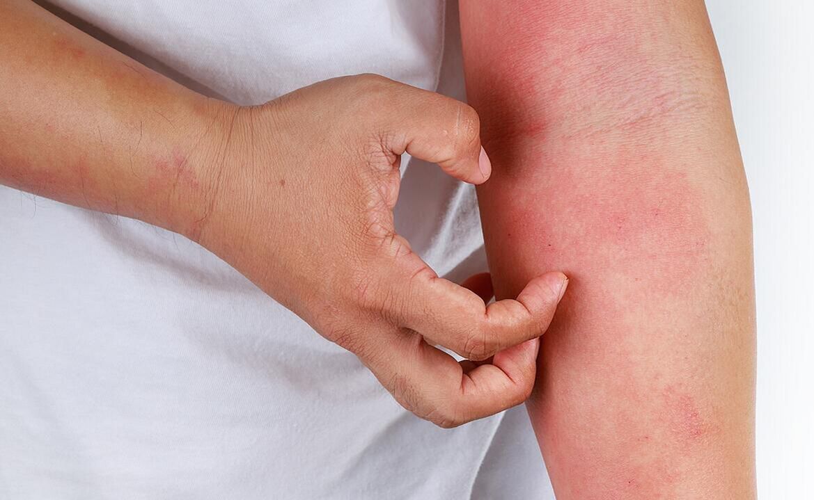 使用软饮料可能出现的并发症